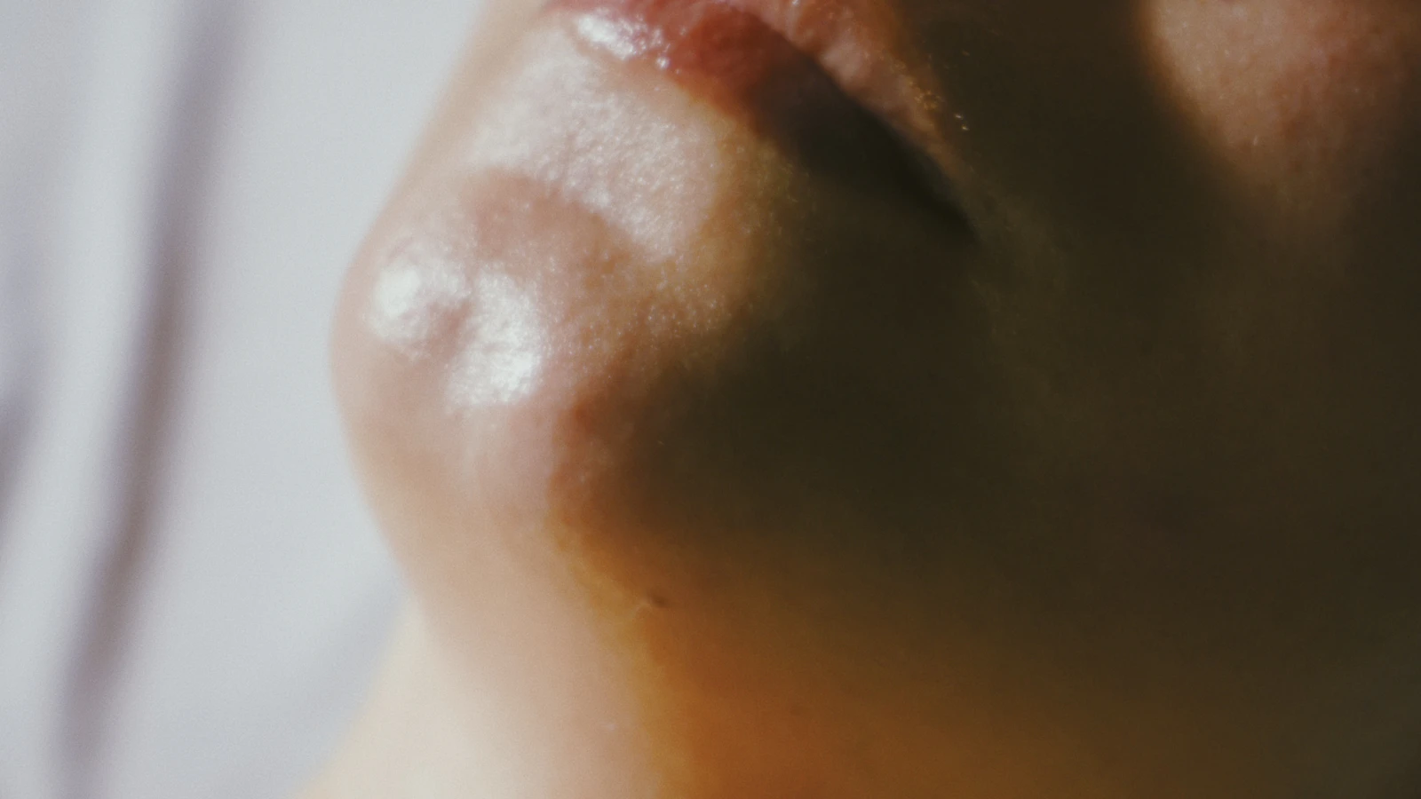 A close view of a person’s cheek and nose.
